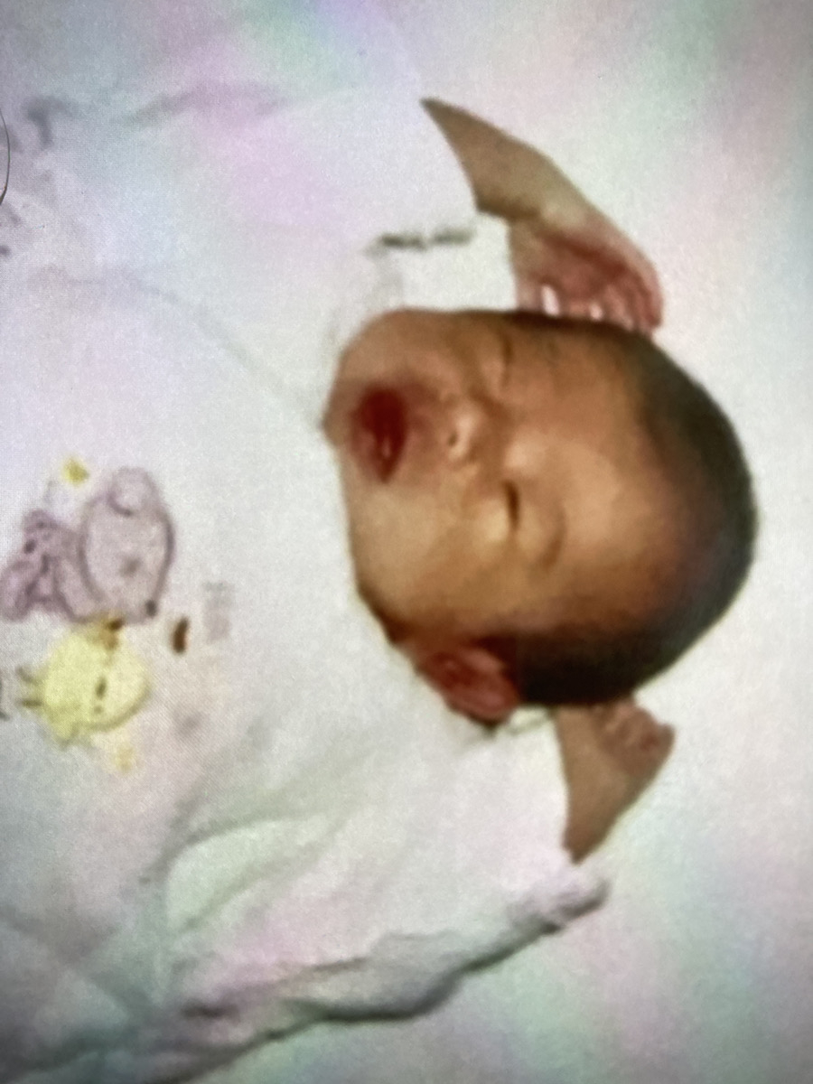 森の木：私の幼少期（栁田）